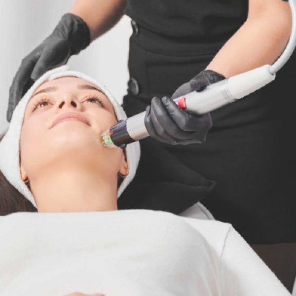 radiofrekwencja mikroigłowa