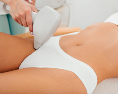 depilacja laserowa bikini