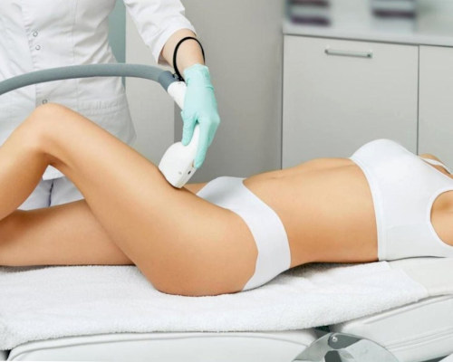 depilacja laserowa nóg