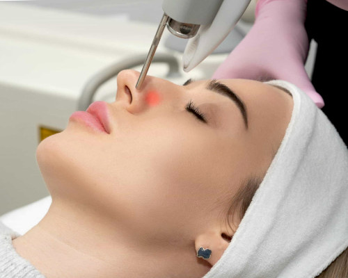 laserowe zamykanie naczynek