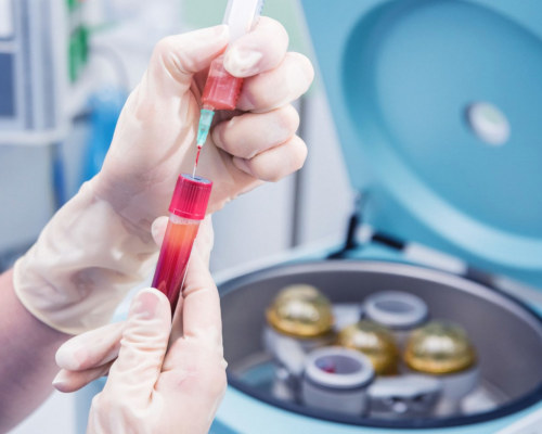 osocze bogatopłytkowe prp